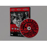 Cadena Perpetua DVD Crónicas 25 Años Tour